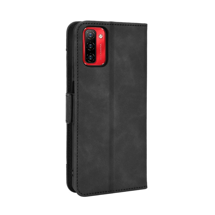 For Ulefone Note 12P Skin Feel Calf Pattern Leather Phone Case(Black) - Ulefone Cases by buy2fix | Online Shopping UK | buy2fix